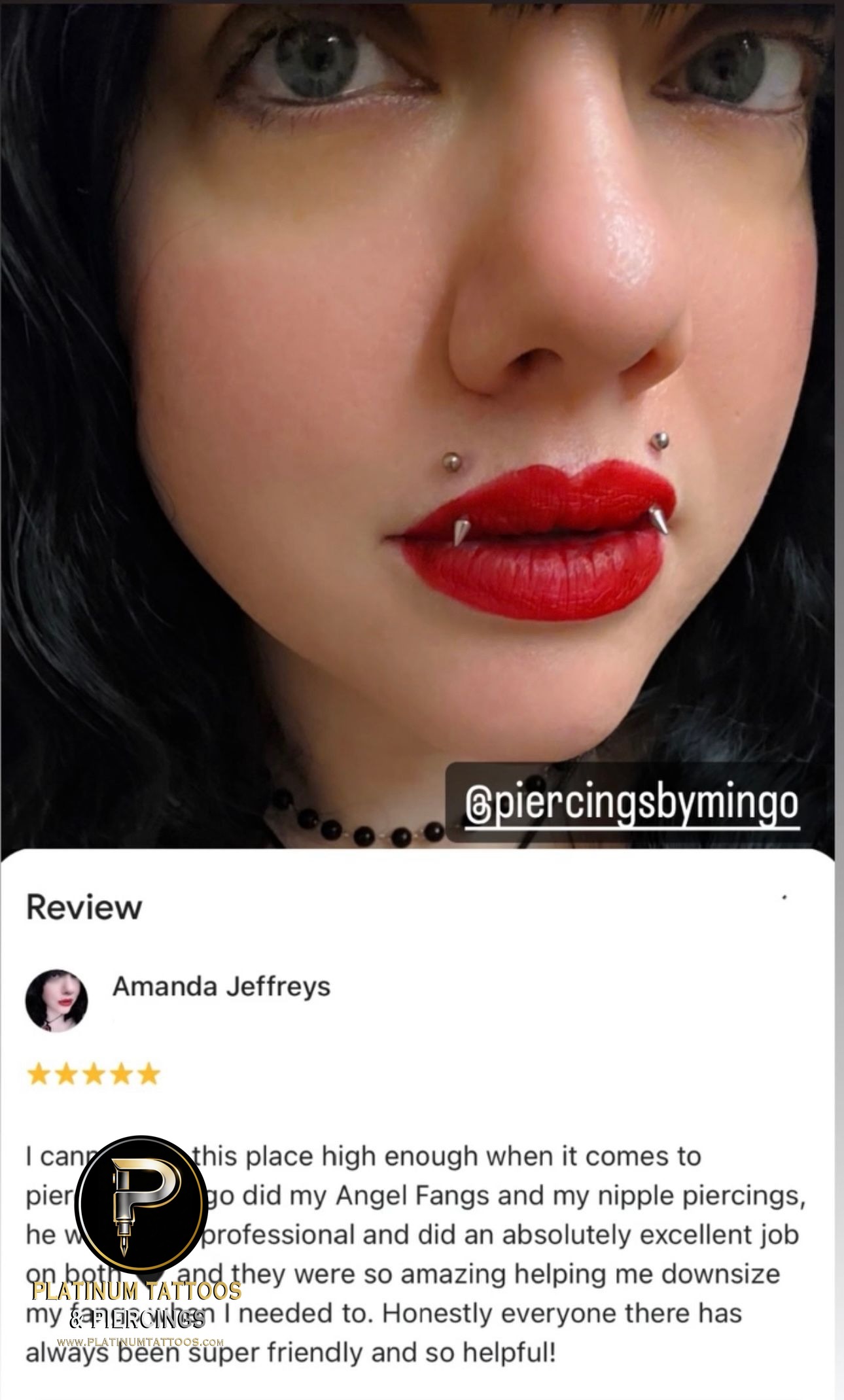 Angel Bites piercing with Implant Grade Titanium Curved Barbell by Other by Mingo at Platinum Tattoos & Piercings, San Antonio TX