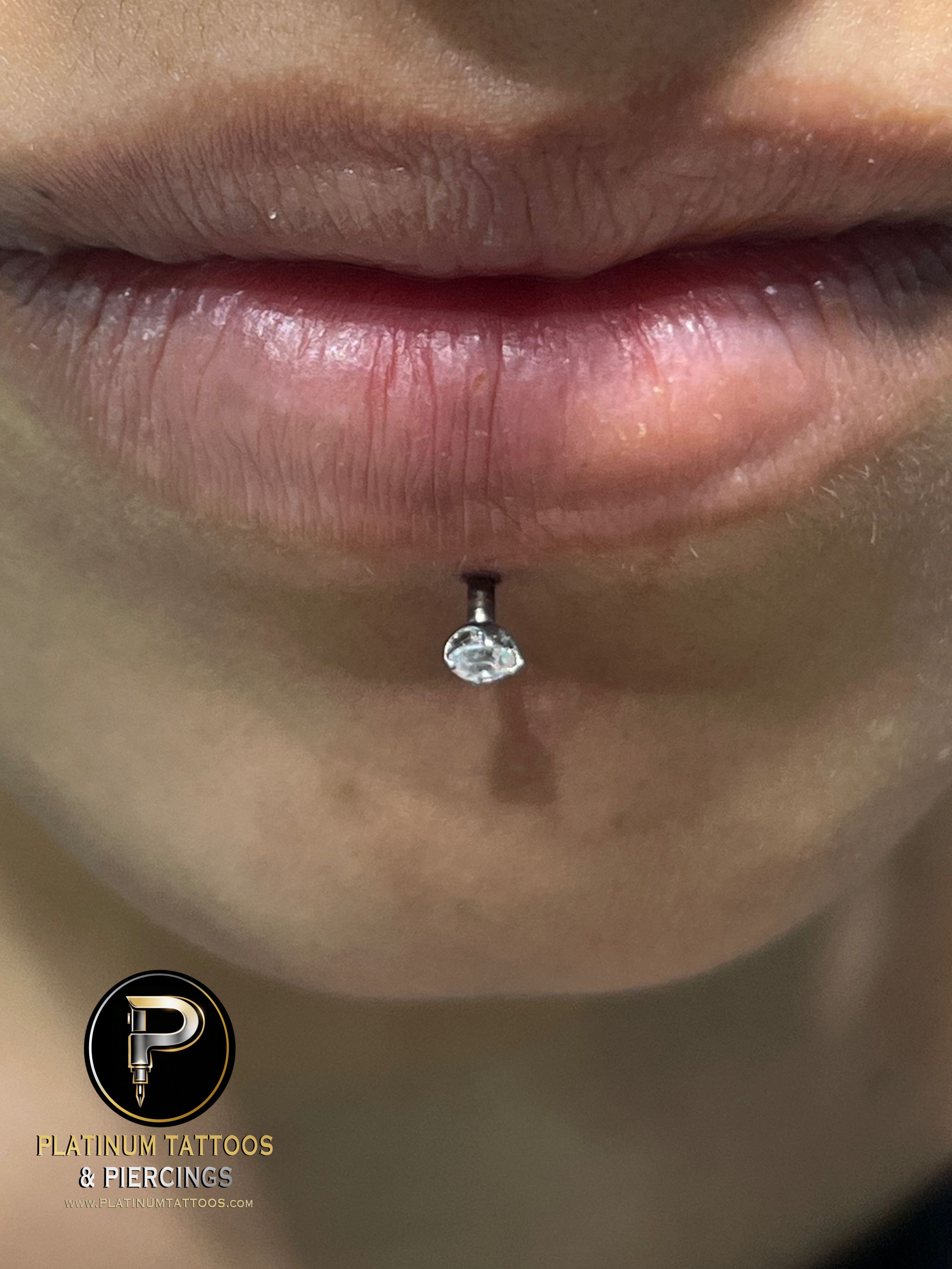 Labret piercing with Implant Grade Titanium Labret Stud/Flat Back by NeoMetal by Harley at Platinum Tattoos & Piercings, San Antonio TX