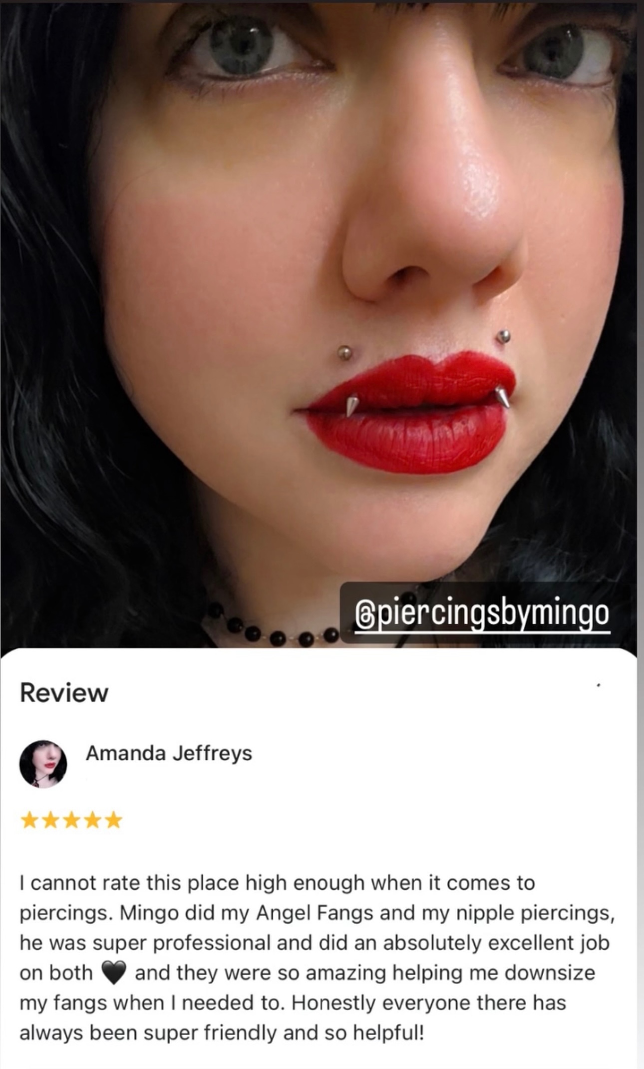 Angel Bites piercing with Implant Grade Titanium Curved Barbell by Other by Mingo at Platinum Tattoos & Piercings, San Antonio TX