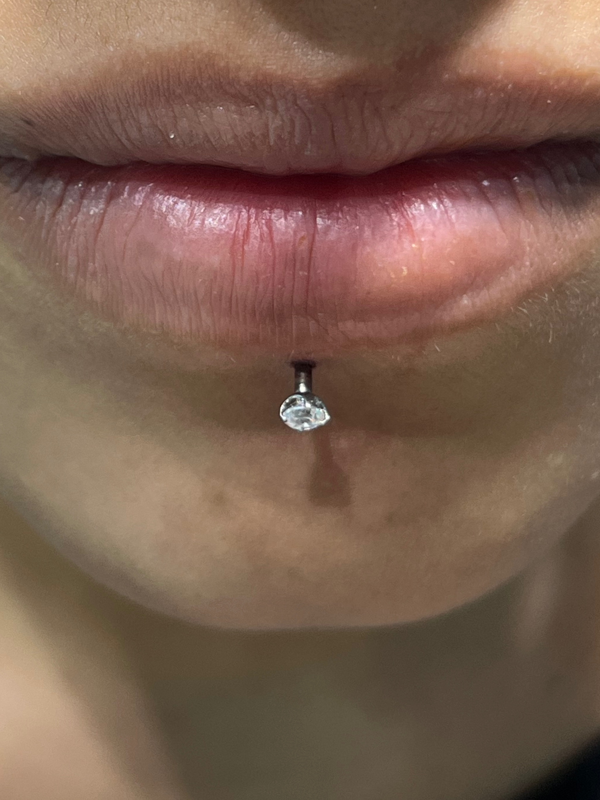 Labret piercing with Implant Grade Titanium Labret Stud/Flat Back by NeoMetal by Harley at Platinum Tattoos & Piercings, San Antonio TX