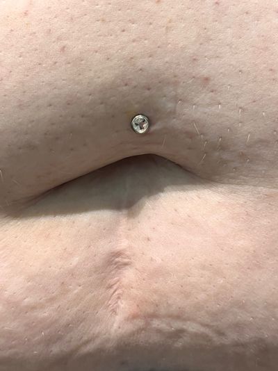 Belly Button piercing with Implant Grade Titanium Curved Barbell by Other by Harley at Platinum Tattoos & Piercings, San Antonio TX