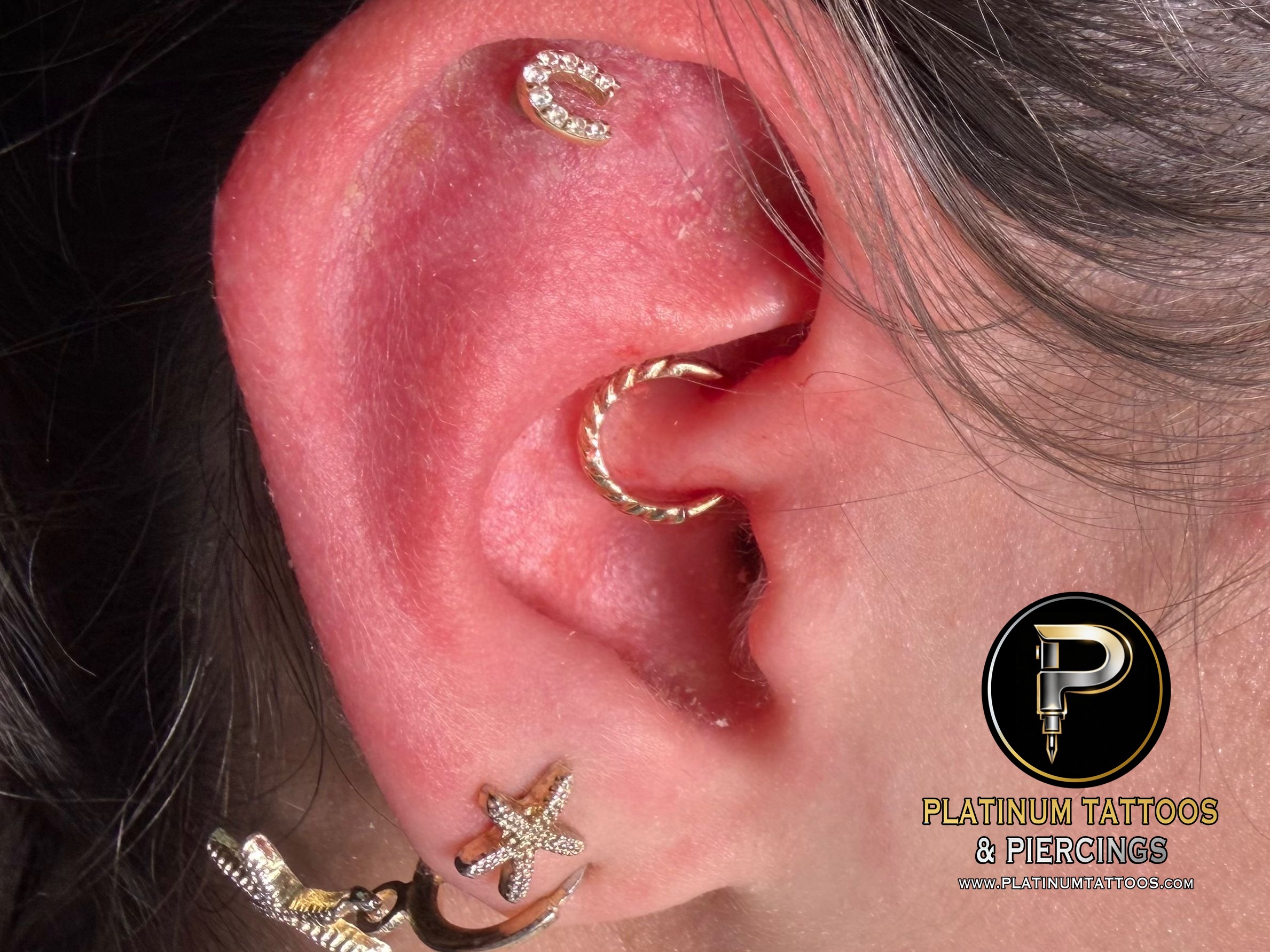 Daith piercing with 14k Yellow Gold Hoop/Ring by Other by Mingo at Platinum Tattoos & Piercings, San Antonio TX